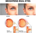 6x Best Cataract Eye Drops Glaucoma  Non Carnosine  nac   Can Cataracts C Bright