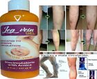 Natural Ointment Varicose Veins Vasculitis Support Foot Care Cream Usa Spider