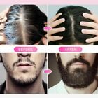 Beard Derma Roller For Hair Loss And Fast Beard Growth 540 0 5-2 0mm Microneedle