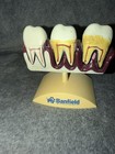 Banfield Dental Anatomy Model Tooth Disease Periodontal Disease Bone Loss- Vet