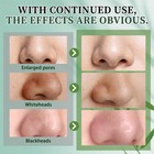 Blackhead Remover Mask  Charcoal Peel Off Face Mask Kit  Deep Cleaning Whiteh   