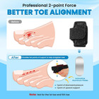 Hammer Toe Straightener - 2pcs Hammer Toe Correctors For Women   Men - Toe Splin