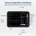 12-inch Patient Vital Signs Monitor Multi-parameter Ecg nibp temp resp spo2 pr