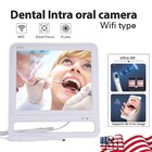 17 Inch Dental Intra Oral Camera 16 Megapixel Intraoral Lcd Monitor With Holder