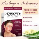 Prosacea - Heals Rosacea Symptoms Of Redness Pimples And Irritation - 0 75 Oz