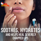 Chapstick Classic Medicated Lip Balm Tubes  Chapped Lips Treatment And Skin Prot