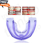 Myobrace Tooth Orthodontics Braces Veneers Anti Molar Orthodontic Retainers Dent