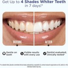 Gurunanda Teeth Whitening Strips - 4x Whiter Teeth  7-day Whitening Kit