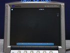 Sonosite M-ob gyn Office M-turbo Portable Ultrasound