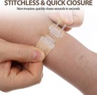 5 Pack Emergency Wound Closure Strips Laceration Butterfly Sutures Bandage