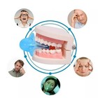 2xanti Snoring Sleep Aid Device Silicone Tongue Mouthpiece Snore Stopper W case 