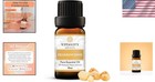 Natural Frankincense Essential Oil 10ml - Stress Relief   Skin Care Essential