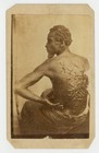 Gordon Peter Cdv 1863 Escaped Slave Abolitionist Photo Original Civil War 
