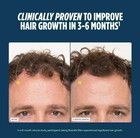 Pack Of 3 Men s Hair Growth Total 360 Capsules Free Ship From Usa