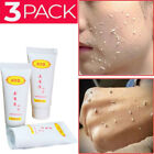 Whitening Peeling Facial Scrub Gel Natural Exfoliating Dead Skin Remover 3bottle