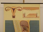 Female Reproductive Organs 1962 School Wall Chart 83x114cm Uterus Ovary