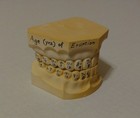 Vintage Plaster Dental Teeth Models Molds Dentist Cast Impressions Oddity