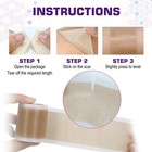 Scar Removal Silicone Tape For Hypertrophic Scars   Keloids  4cmx150cm