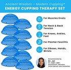 Energy Cupping Therapy Sets Trigger Points  Joints  Arthritis  Plantar Fasciitis