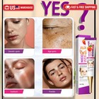 Dark Spot On The Face  Niacinamide 20g Crema Para Manchas Oscuras En La Cara  Me