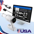 Portable Dental X Mobile Ray Machine Unit High Frequency   Sensor 2 No Shield