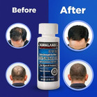 Kirkland Signature Minoxidil 5  Hair Regrowth Men 6 12 Month Supply Us