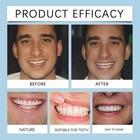 Soft Silicone Denture Kit 2025   Upper   Lower Teeth Liner Dental Care