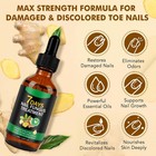 7 Days Nail Fungus Treatment     Extra Strength Repair For Nails   Cuticles 60ml
