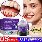 Dental Restoration Mineral Powder  Mineral Tooth Powder  Teeth Whitening Us Hot