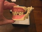 Frasaco Dental Typodont For Periodontal Scaling  Barely Used At All  In Box