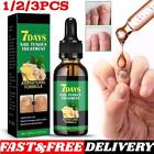 Ginger Nail Treatment Nail Care  Nail Growth Oil For Cuticle Nourishment   