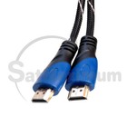 2-pack - 20ft Hdmi 4k Premium Braided Cable 60hz 1080p Hdtv 3d Xbox Ps5 Cord
