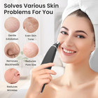 Diamond Microdermabrasion Machine   Rechargeable Micro Dermabrasion Facial Tool