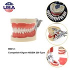 Kilgore Nissin 200 Type Dental 32pc Typodont Model Removable Teeth Mounting Pole