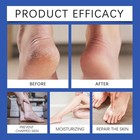 Diabetic Foot Cream Moisturizing Sensitive Skin Non-greasy 20g Men Women