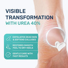 Urea Cream 40 Percent For Feet Maximum Strength - Urea Foot Cream And Callus Rem