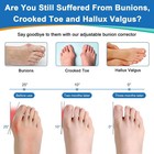  2x Bunion Corrector For Women Men Night Splint Big Toe Straightener Pain Relief