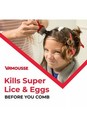  2 Pack vamousse Lice Treatment Mousse clinically Proven To Kill Super Lice