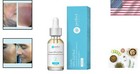 Level 2 Lactic Acid Chemical Peel For Fine Lines And Brightening - 30 Ml
