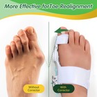 Bunion Big Toe Corrector Splint Straightener Hallux Valgus Foot For Women Men