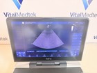 Ge Vivid Iq 2018 Portable Ultrasound System With Power Adapter And Extra Battery