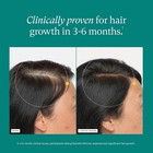 Pack Of 3 Women   s Hair Growth Supplement 360 Caps     Fast Shipping Ages 18 - 44