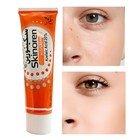 Skinorenazelaic Acid 20  Anti Acnetreatment Personal Skin Care