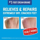 Healthy Feet Foot Cream 3 2 Oz Jar 1pack For Extreme Dryness