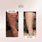 Fasciablaster The Problaster Handheld By Ashley Black  Brand New Box