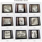 Rare 1920 s  Venereal Disease Medical Slides  81 