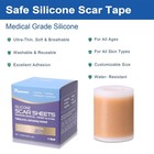 Silicone Scar Sheets   Tape For Surgical Scares  C-section  Tummy Tuck   Keloid 