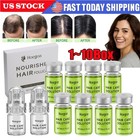 8pcs set Microneedle Hair Regrowth System  Advanced Hair Treatment Ginseng Serum