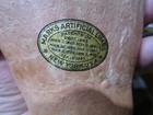 Antique Vintage A  A  Marks Prosthetic Artificial Hand With 2 Attachments