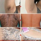 Permanent Hair Removal Cream Hair Growth Inhibitor Face Arm Armpit Leg Intimate